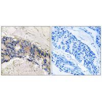 CA1 Antibody
