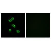 CA5B Antibody