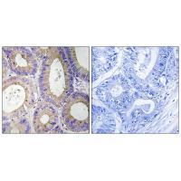 CBR3 Antibody
