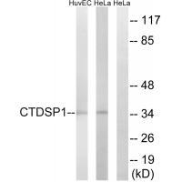 CTDSP1 Antibody