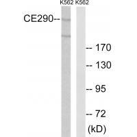 CEP290 Antibody