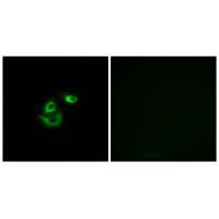 CLCC1 Antibody