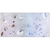 CHSY1 Antibody 