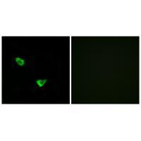 CHSS2 Antibody