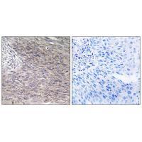 CHSS2 Antibody