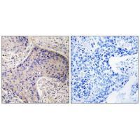 ST6GAL1 Antibody
