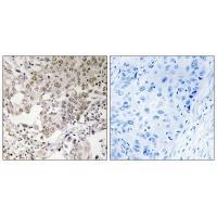 NCAPG2 Antibody