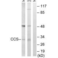 CCS Antibody