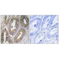 CST2 Antibody