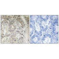 CST1 Antibody