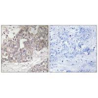 ATG4C Antibody