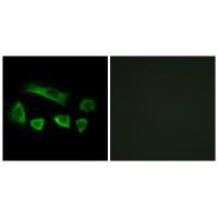NT5C1B Antibody