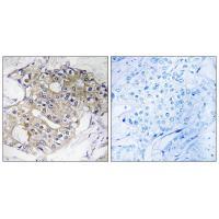 DHRS4 Antibody