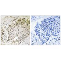 RFX2 Antibody