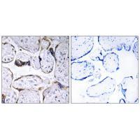 ELOVL3 Antibody