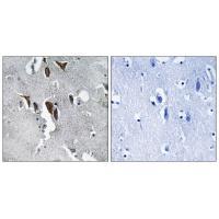 ELOVL5 Antibody