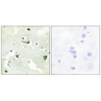 EPHB1/2/3 Antibody