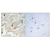 GPRIN2 Antibody