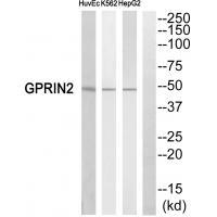 GPRIN2 Antibody
