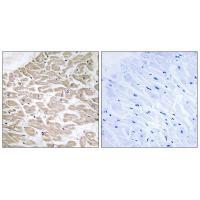 RAD Antibody