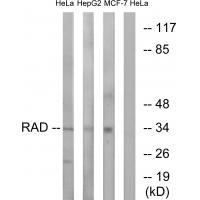 RAD Antibody