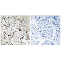 SAR1B Antibody