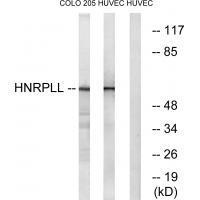 HNRPLL Antibody 
