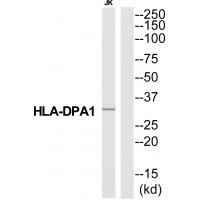 HA2Q Antibody