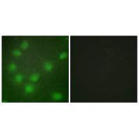 HOXA11/D11 Antibody