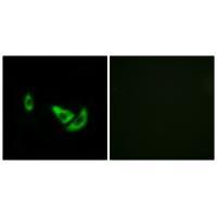 DCT Antibody