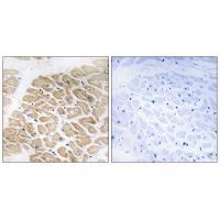 MIA Antibody