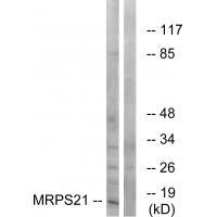 MRPS21 Antibody