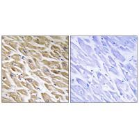 MRPL39 Antibody