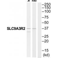 SLC9A3R2 Antibody
