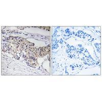 NDUFA3 Antibody