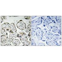 MT-ND1 Antibody