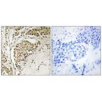 NOM1 Antibody