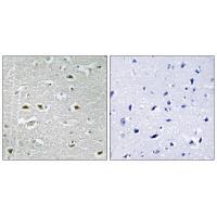 URB1 Antibody