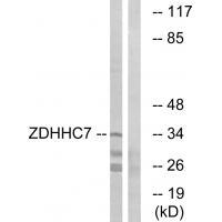 ZDHHC7 Antibody