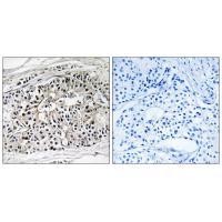 EHHADH Antibody
