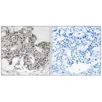 PXMP3 Antibody