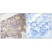 PEX10 Antibody