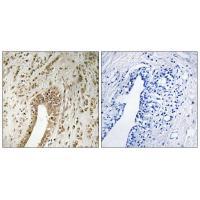 PHF3 Antibody