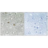 PIGH Antibody