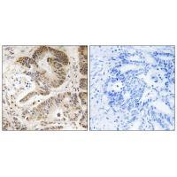 PIK3R5 Antibody
