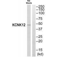 KCNK12 Antibody