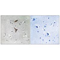 KCNT1 Antibody