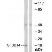 SF3B14 Antibody