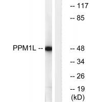PPM1L Antibody 