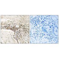 SSH3 Antibody